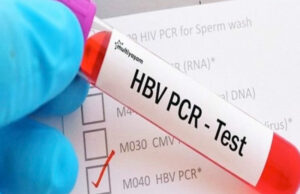 سعر تحليل pcr معمل المختبر